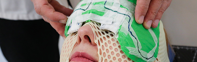 ZORTRAX 3D Printed Skull Facial Reconstruction Surgery Bolus